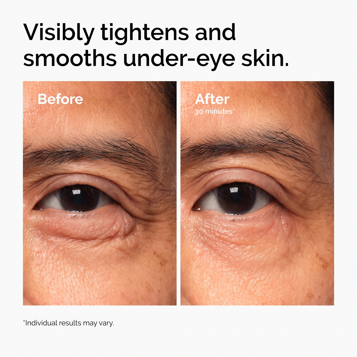 Lacto-PDRN 4% + B9 Eye Cream